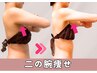 【二の腕肉撃退】ノースリーブだって怖くない！隠すから見せる腕へ♪