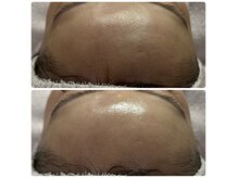 リアスキン(Lia skin)