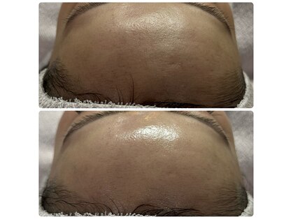 リアスキン(Lia skin)の写真