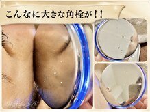 マリア(MALIA)の雰囲気（#韓国式毛穴#角栓チンアナゴ#esv10南森町#大阪esv10導入サロン）