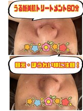 シンシア(SINCERE)/うる艶肌トリートメント60分施術
