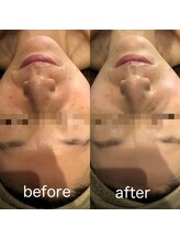 ディースズ(D.suzu)/【パック人気No.1】復元パック