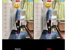 みふく整体院/猫背改善