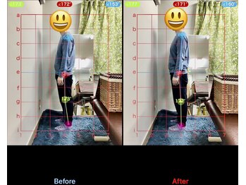 みふく整体院/猫背改善