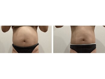 ラナビューティリゾート(Lana Beauty resort)/エステ担当★40代