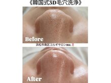 ミードット(me.)の雰囲気（お悩みの毛穴の黒ずみザラつきは1回でツルツルになります(^^)♪）