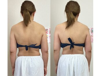 サロンペタル 浦安(Salon Petal)/一度で浮き輪肉が薄く