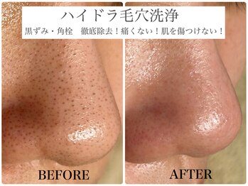 アンドエルビオ(&Elbio)