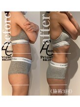 アムール 麻布十番(Amour)/エンダモロジー×お腹