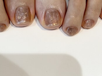 フットネイル、ふっとえ
