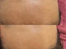 GRACETHOUSAND(グレイスサウザンド)/乾燥/ニキビケア/赤ら顔/敏感肌