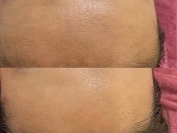 GRACETHOUSAND(グレイスサウザンド)/乾燥/ニキビケア/赤ら顔/敏感肌