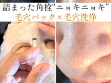 アイムエステ 千葉富士見本通り店(i'm este)の雰囲気（毛穴パック×毛穴洗浄）