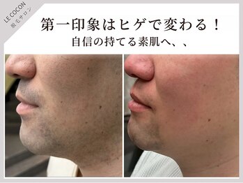 ル ココン(le cocon)の写真/【完全都度払い制】無理な勧誘なし×コース契約なし◎自分のペースで理想のツルスベ肌を叶えるサロン♪