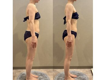 アンドミー(and me)の写真/ダイエット難民からの卒業!自分史上1番好きな自分になれる♪人生変わる本気のダイエット