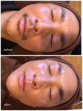 ソワイユ 浜松店(Soyeux)/ワックス脱毛（Waxxxx）