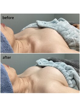 ウルーフ(ulu-fu)/BBLバストアップ