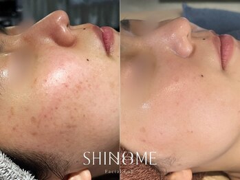 シノノメ(SHINONOME)/*お肌のトーン