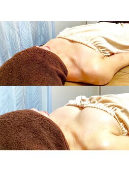 コモド(COMODO)/バストアップ・ケアbefore&after