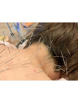 首・肩のつらさを改善したい