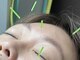 グリーン整骨院の写真/【疲れ・むくみ・眼精疲労・腰痛・凝り・たるみにお悩みの方へ】鍼施術で辛い身体の不調や肌悩みも改善！