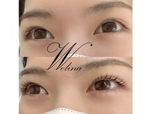 ウェリナ(welina)/