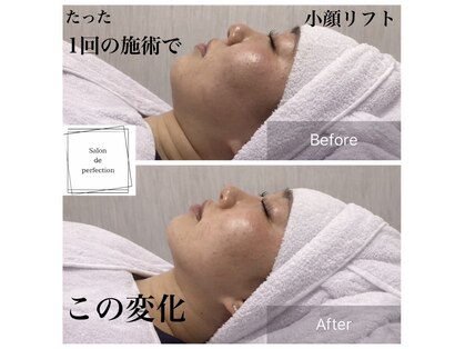 サロン ド パーフェクション(Salon de Perfection)の写真