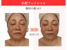 3月限定◇小顔造形60分(クレンズ/角質/背中&顔ハンド/水素マスク)通常￥17600