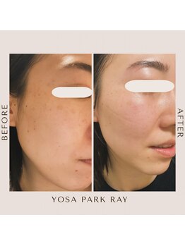 ヨサパーク レイ 等々力(YOSA PARK Ray)/お客様の変化 水素コース