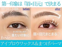 エトワール(Etoile)/垢抜けセット◎