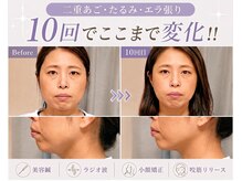 カンワ美容鍼灸院(KANWA美容鍼灸院)