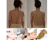 ミーティット(Meetite)