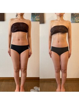 ララルアナ(Lara luana)/疲労回復とダイエットが同時に◎