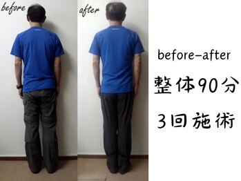 からだ庵 弘明寺本院/before-after：50代男性 施術3回