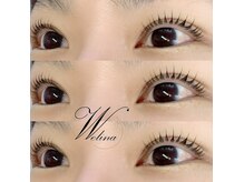ウェリナ(welina)/