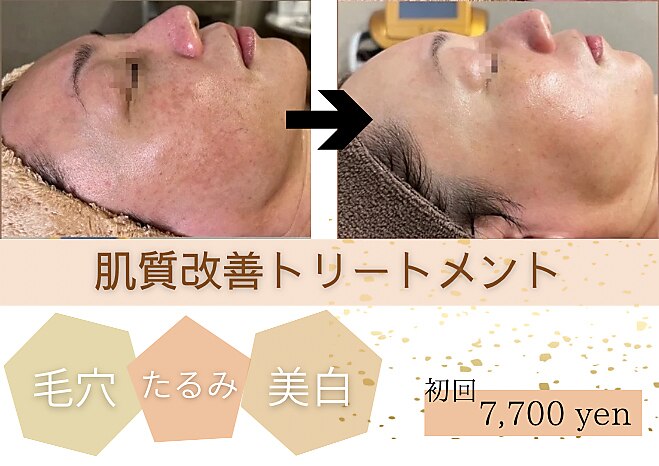 エクラ(ECLAT)｜ホットペッパービューティー
