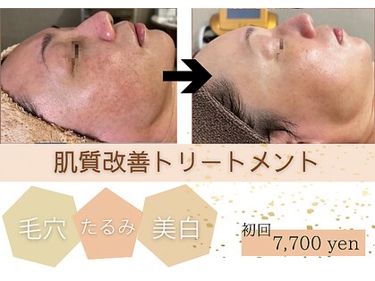 エクラ(ECLAT)の写真