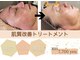 エクラ(ECLAT)の写真