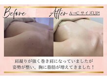 リーズリアン(Rises Lien)/【BeforeAfter】30代 バストUP!