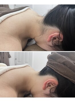 ミース 北九州店/『うなじビフォーアフター』