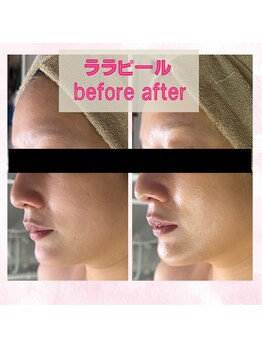 ベル(Belle)/艶肌へ