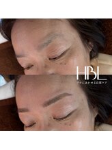 イチ(ichi)/HBL