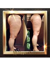 美癒 池袋本店/【ビフォア⇒アフター】（3）