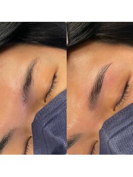 エクリプス(ECLIPSE)/メンズ【Hollywood blow lift】