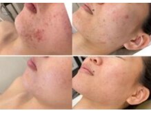 エスビューティー 三軒茶屋(S beauty)/たるみ・池尻大橋・痩身