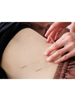 腰のつらさを改善したい