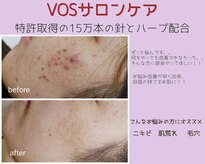 ペシェ ココ(Peche coco)