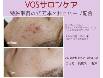 アンティクイーン(Antiqueen)