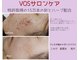 ペシェ ココ(Peche coco)の写真
