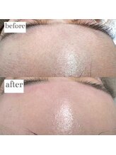 ホワイトラボ 名古屋栄(White labo)